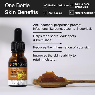 Soulflower Frankincense Essential Oil- Pure, Organic, Natural & Undiluted Therapeutic Grade Essential Oil| Healthy Hair, Face, Skin Wrinkles, Scalp, Control Acne| Boswellia Genus -Chemical Free|15ml